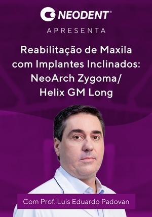 Cover for Reabilitação de Maxila com Implantes Inclinados: NeoArch Zygoma/Helix GM Long