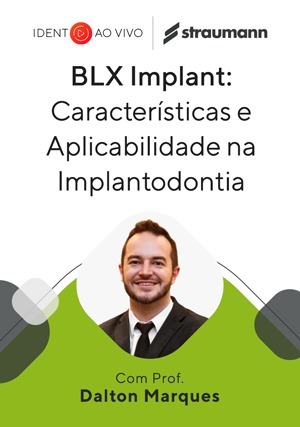 Cover for BLX Implant: Características e Aplicabilidade em Busca da Excelência na Implantodontia