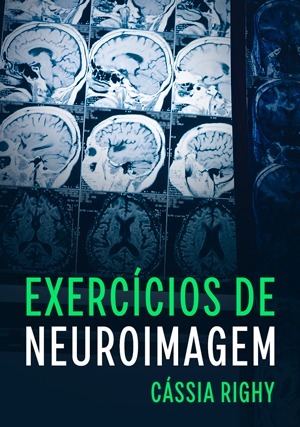 Cover for Exercícios de Neuroimagem