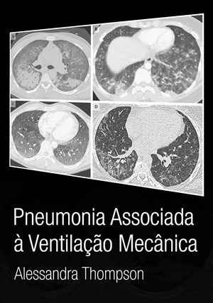 Cover for Pneumonia Associada à Ventilação Mecânica