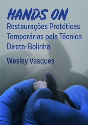 Cover for Hands On: Restaurações Protéticas Temporárias pela Técnica Direta-Bolinha