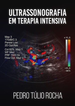 Cover for Ultrassonografia em Terapia Intensiva