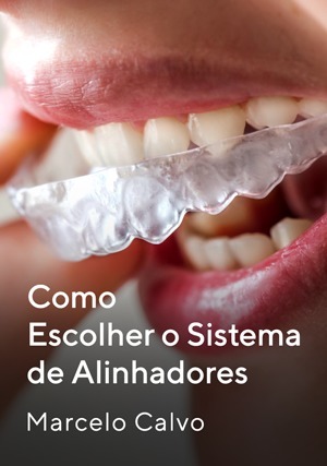Cover for Como Escolher o Sistema de Alinhadores