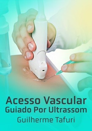 Cover for Acesso Vascular Guiado Por Ultrassom