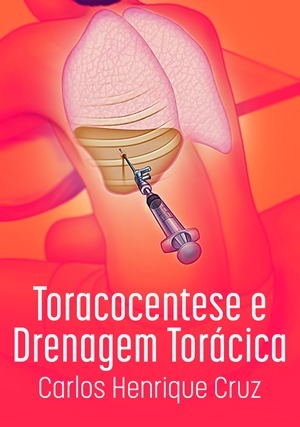 Cover for Toracocentese e Drenagem Pleural