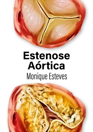 Cover for Estenose Aórtica