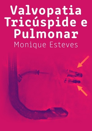 Cover for Valvopatia Tricúspide e Pulmonar