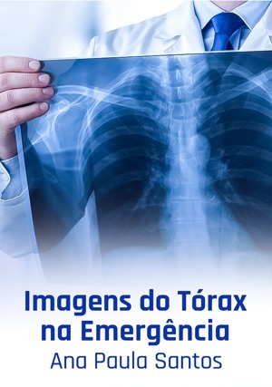 Cover for Imagens do Tórax na Emergência
