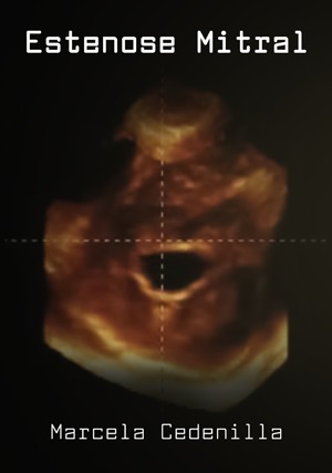 Cover for Estenose Mitral