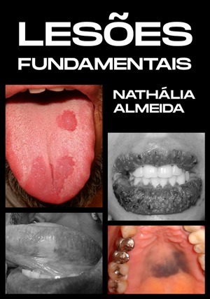 Cover for Lesões Fundamentais