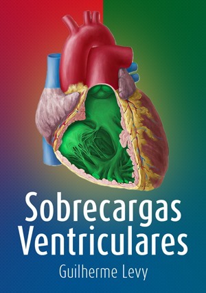Cover for Sobrecargas Ventriculares