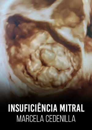 Cover for Insuficiência Mitral