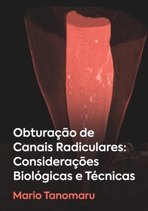 Cover for Obturação de Canais Radiculares: Considerações Biológicas e Técnicas