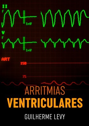 Cover for Arritmias Ventriculares