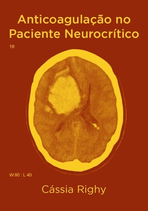 Cover for Anticoagulação no Paciente Neurocrítico