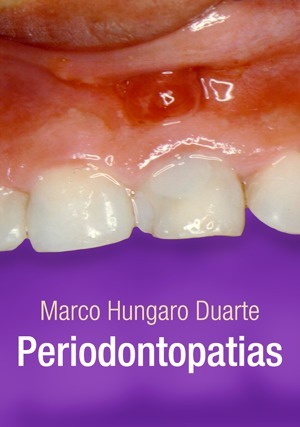 Cover for Periodontopatias