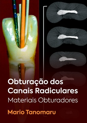Cover for Obturação dos Canais Radiculares - Materiais Obturadores