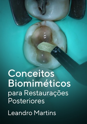 Cover for Conceitos Biomiméticos para Restaurações Posteriores