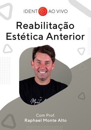 Cover for Tire Suas Dúvidas Sobre: Reabilitação Estética Anterior