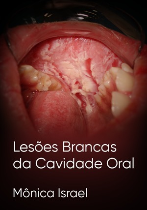 Cover for Lesões Brancas da Cavidade Oral