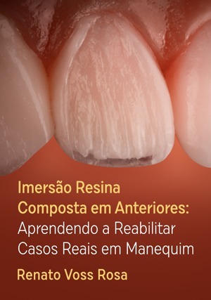 Cover for Imersão Resina Composta em Anteriores: Aprendendo a Reabilitar Casos Reais em Manequim