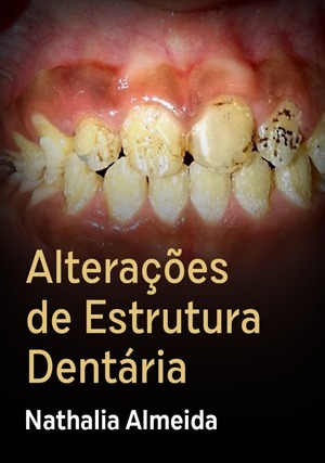 Cover for Alterações de Estrutura Dentária