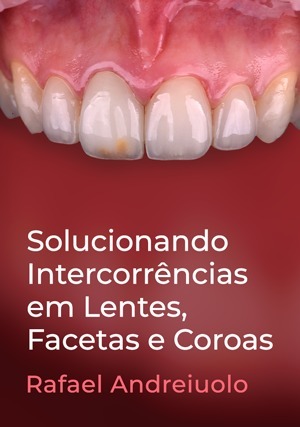 Cover for Solucionando Intercorrências em Lentes, Facetas e Coroas