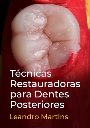 Cover for Técnicas Restauradoras para Dentes Posteriores
