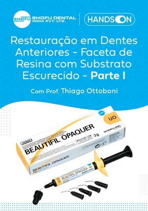 Cover for Hands On: Restauração em Dentes Anteriores - Faceta de Resina com Substrato Escurecido - Parte I