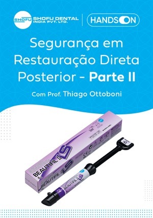 Cover for Hands On: Segurança em Restauração Direta Posterior - Parte II