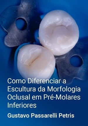Cover for Como Diferenciar a Escultura da Morfologia Oclusal em Pré-Molares Inferiores