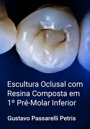 Cover for Escultura Oclusal com Resina Composta em 1º Pré-Molar Inferior