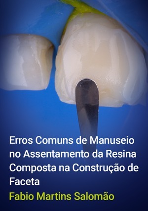 Cover for Erros Comuns de Manuseio no Assentamento da Resina Composta na Construção de Faceta