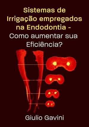 Cover for Sistemas de Irrigação na Endodontia: Como Aumentar sua Eficiência?