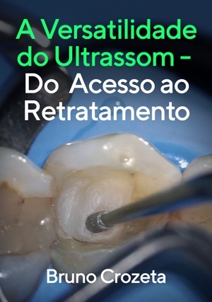 Cover for A Versatilidade do Ultrassom: Do Acesso ao Retratamento
