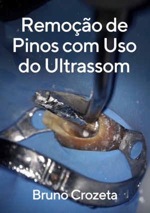 Cover for Remoção de Pinos com Uso do Ultrassom