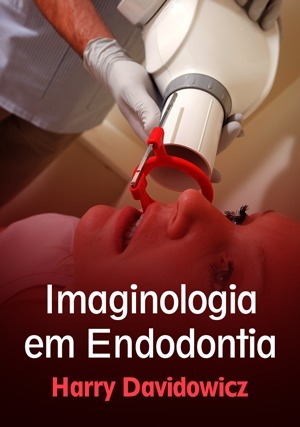 Cover for Imaginologia em Endodontia