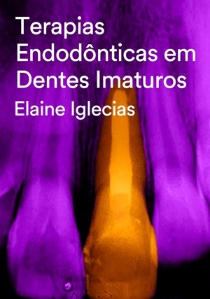 Cover for Terapias Endodônticas em Dentes Imaturos