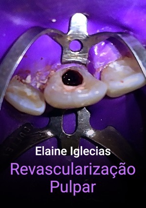 Cover for Revascularização Pulpar