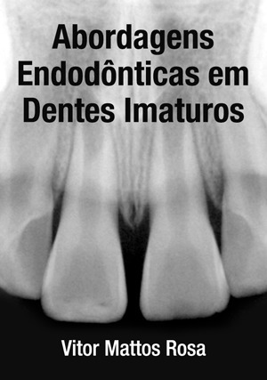 Cover for Abordagens Endodônticas em Dentes Imaturos