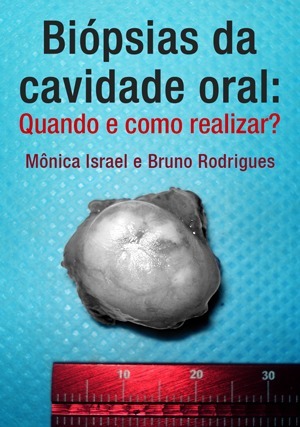 Cover for Biópsias da Cavidade Oral: Quando e Como Realizar?