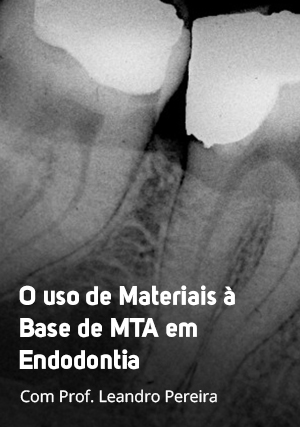 Cover for O Uso de Materiais à base de MTA em Endodontia