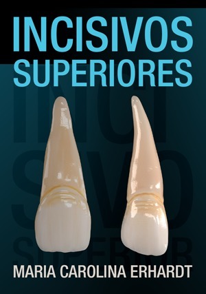 Cover for Incisivos Superiores