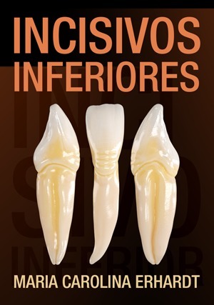Cover for Incisivos Inferiores