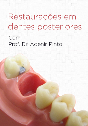 Cover for Restaurações em Dentes Posteriores