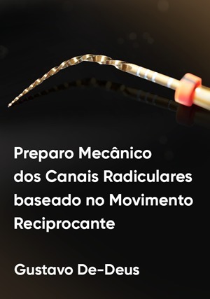 Cover for Preparo Mecânico dos Canais Radiculares Baseado no Movimento Reciprocante
