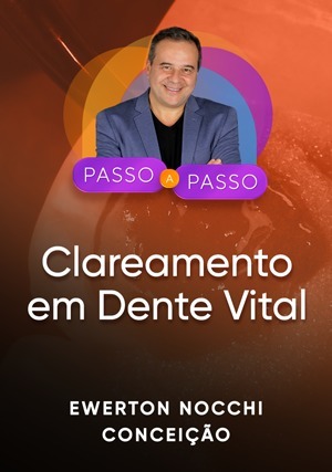Cover for Passo a Passo Clínico: Clareamento em Dente Vital