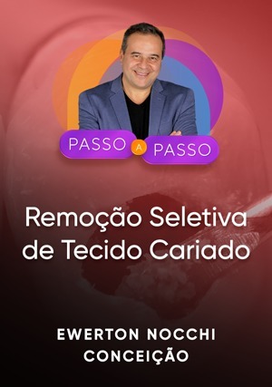 Cover for Passo a Passo Clínico: Remoção Seletiva de Tecido Cariado