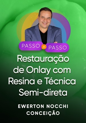 Cover for Passo a Passo Clínico: Restauração de Onlay com Resina e Técnica Semi-direta