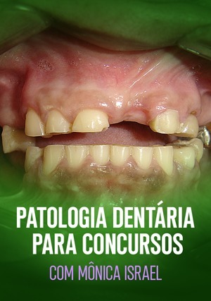 Cover for Patologia Dentária para Concursos